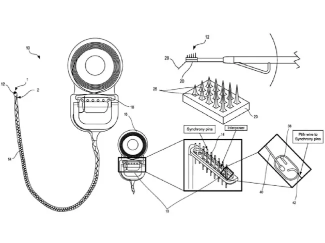 auditory nerve implant