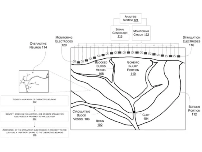 e-stim to reduce stroke damage