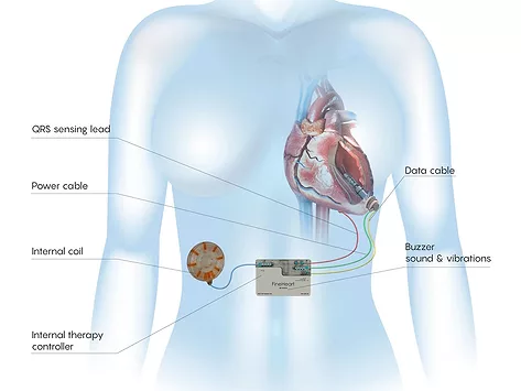 Fineheart flowmaker 111june25