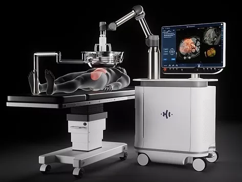 Histosonics edison 10oct25