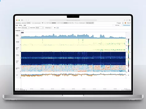 Lvis neuromatch access 1 21