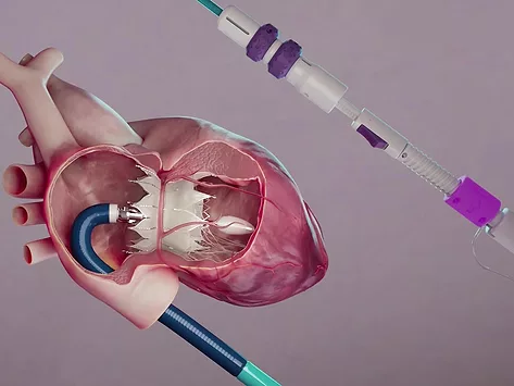 Tricares topaz22may25 