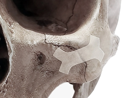 【SURGERY】bone embossing ma-1 bone-tape-20aug25.png?height=