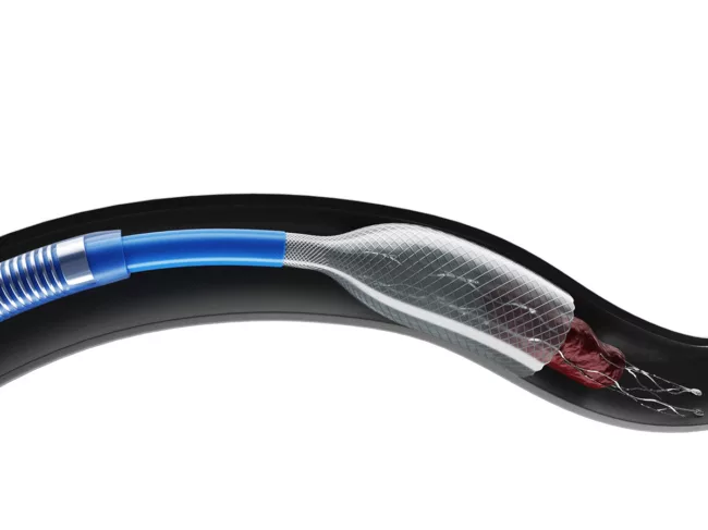 Anaconda Funnel Catheter in vessel