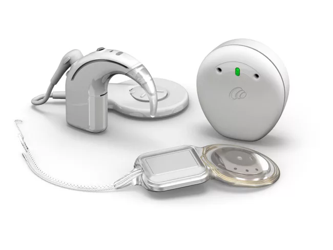 Cochlear Nuclea Nexa system