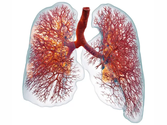 Ebenbuild technology lung with ARDS