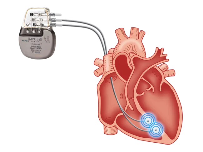 Heart and Optimizer Mini