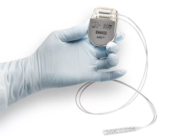 Onward Arc IM system