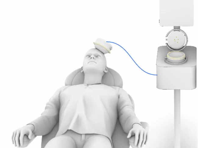 Sonomind ultrasounds brain stimulation system