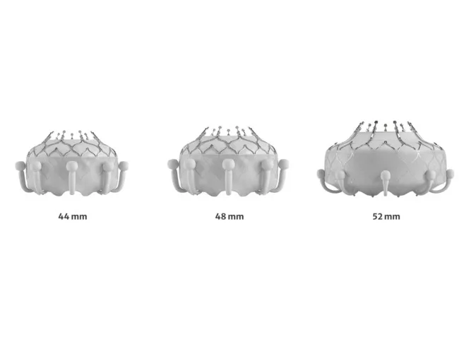 Evoque valve sizes