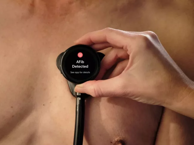 Eko Health AI stethescope