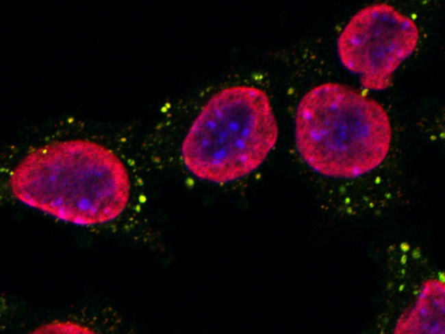 Mouse breast cancer cells