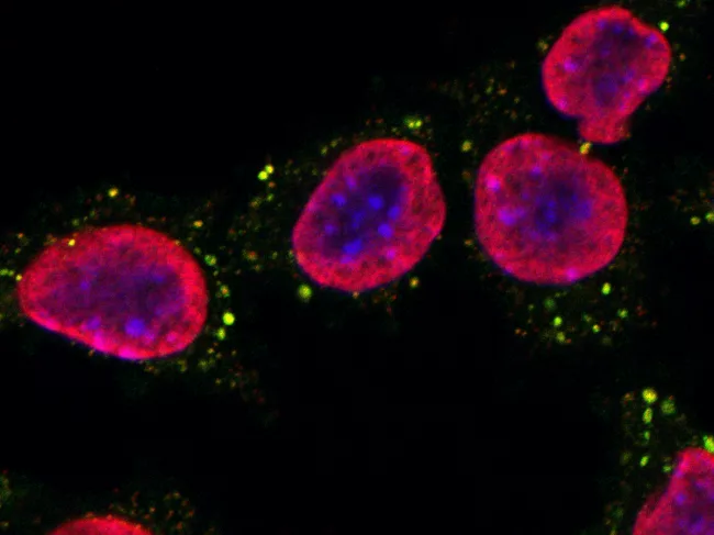 Mouse breast cancer cells 