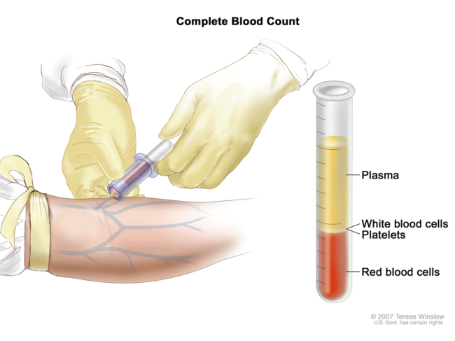 Blood count infographic