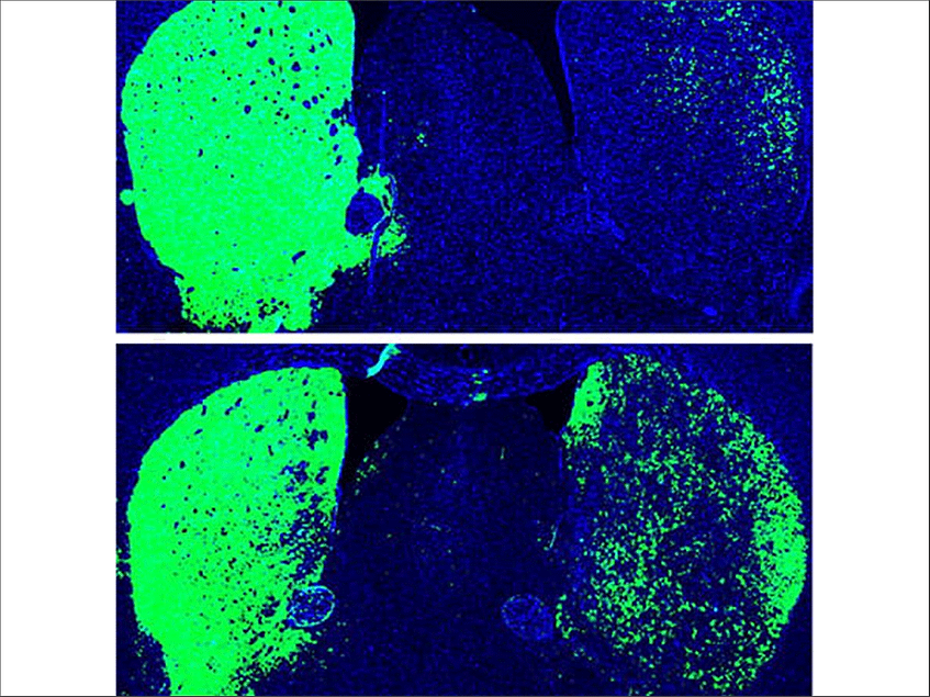 ISSCR 2020: In-brain direct reprogramming creates neurons, alleviates ...