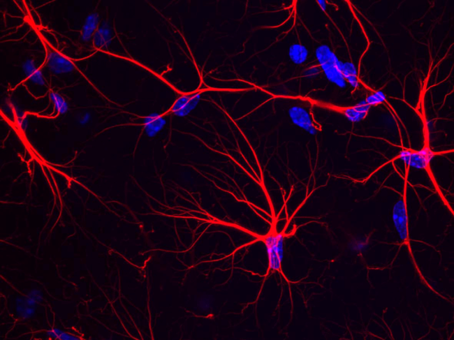 Astrocytes in the mouse hippocampus