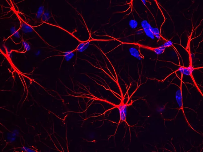 Astrocytes in the mouse hippocampus
