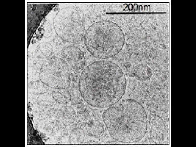 Extracellular vesicles
