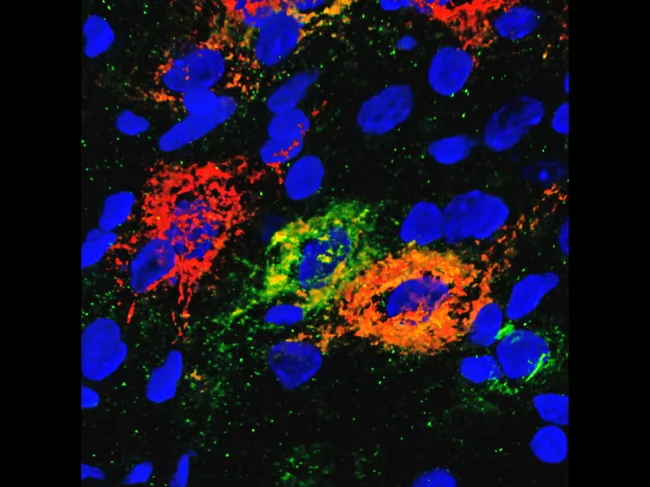 Glucose-regulating neurons