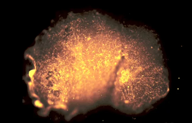 Neural network activity 