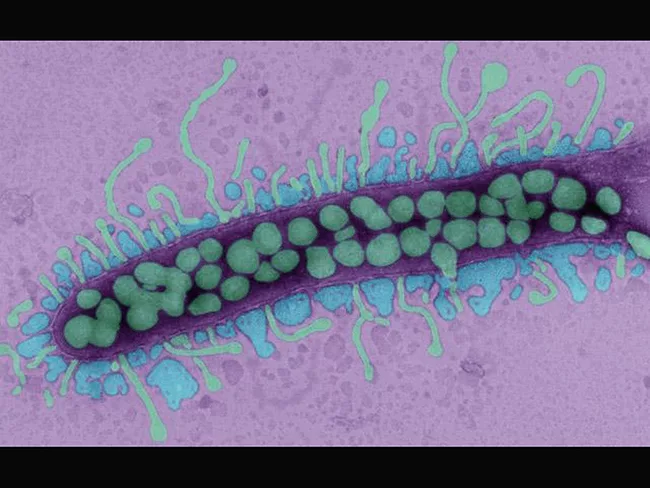 Bacteriophages attacking bacterium
