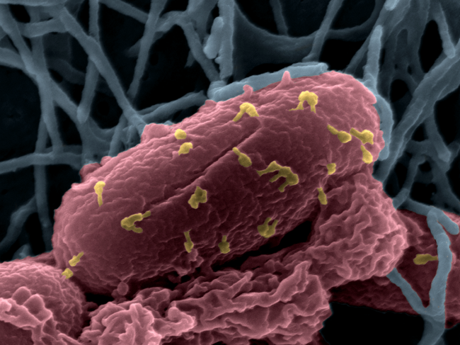 Bacteriophages on E. coli