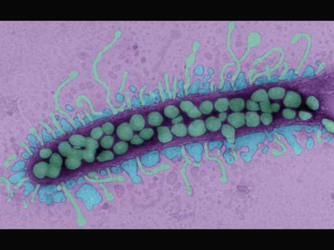 Bacteriophages attacking bacterium