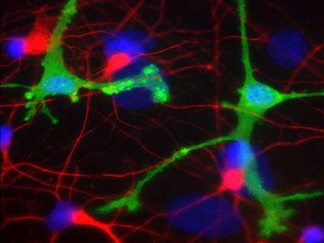 Neurons and microglia