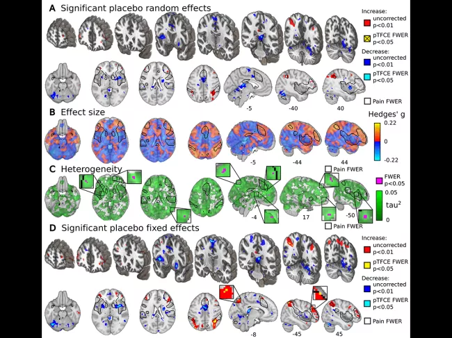Placebo effect graphic