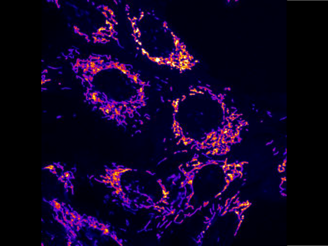 Fluorescence microscopy image of mitochondria