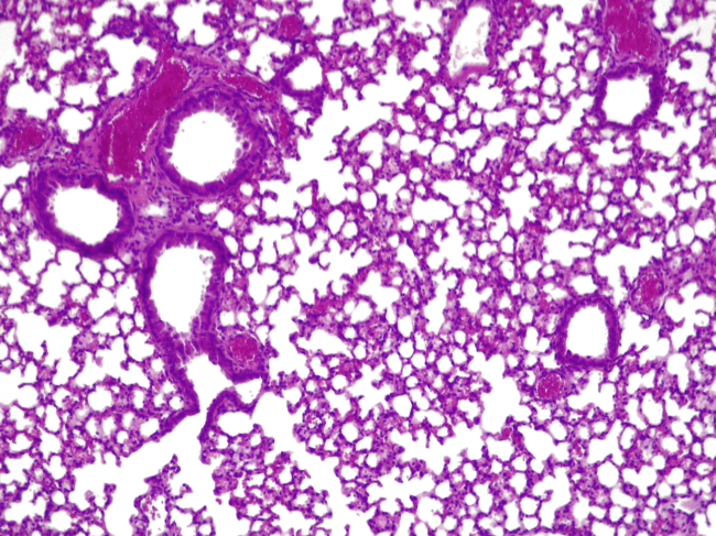Cross-section of a mouse lung infected with P. aeruginosa and treated with engineered M. pneumoniae