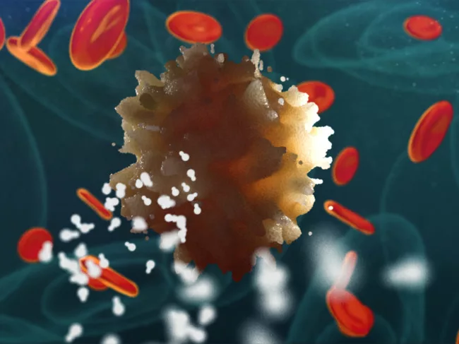 Radioligand seeking cancer cell