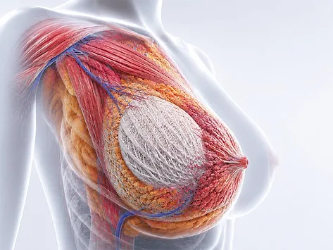 Bellaseno breast scaffold hero 07 02 2026