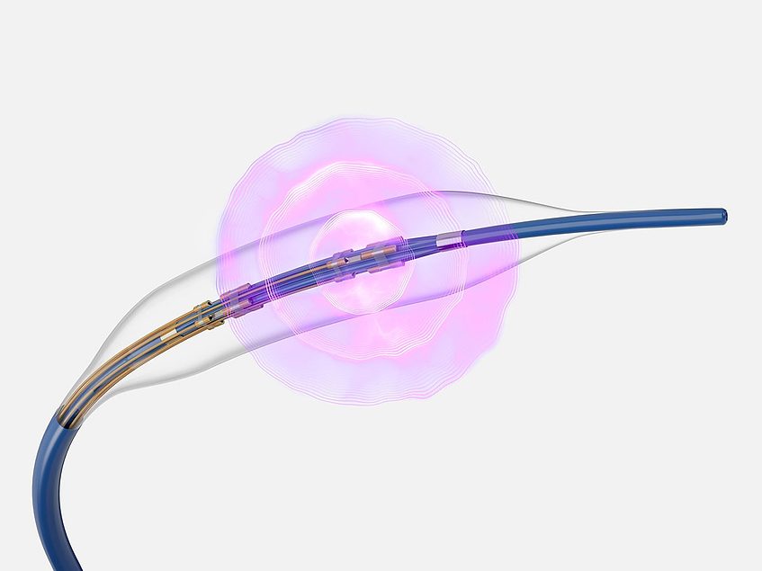 Boston Scientific reports Seismiq IVL data from Fracture study