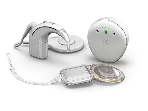 Cochlear nucleus system 4 23