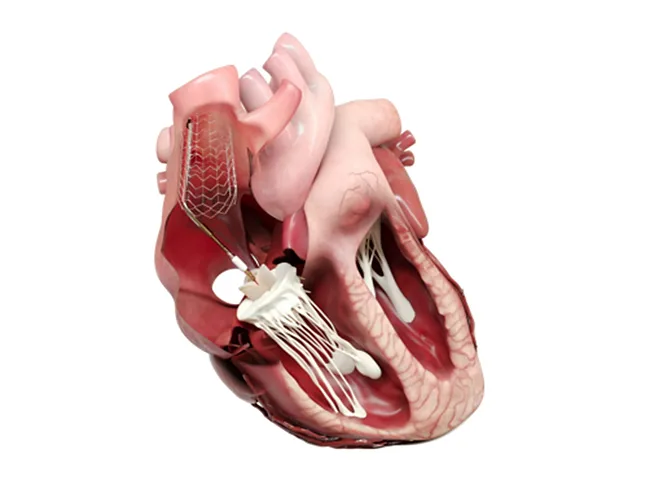 Croívalve Duo System