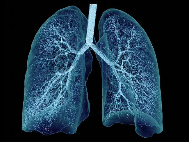 Ebenbuild Lung digital twin with aerosol particles