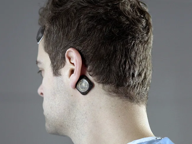 Epitel Remi remote EEG monitoring system