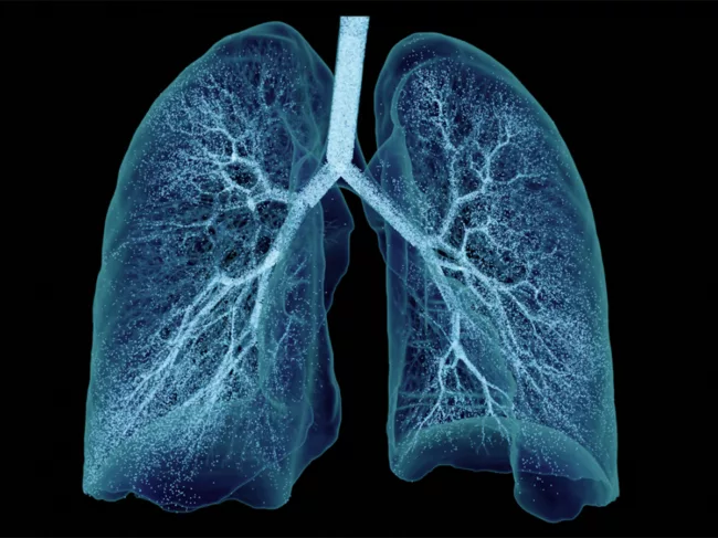 Ebenbuild Lung digital twin with aerosol particles