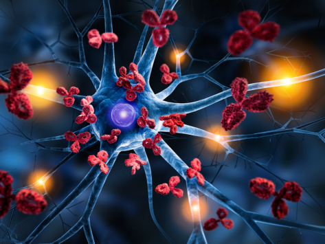Illustration of antibodies attacking nerve cells