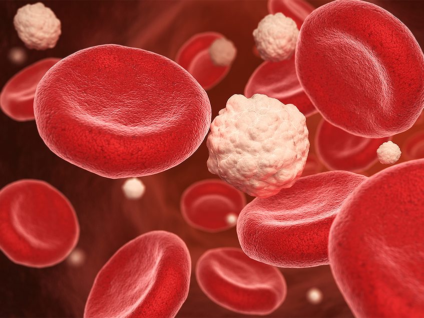 CFTX-2034 successfully shows promise for post-bariatric hypoglycemia in preclinical research