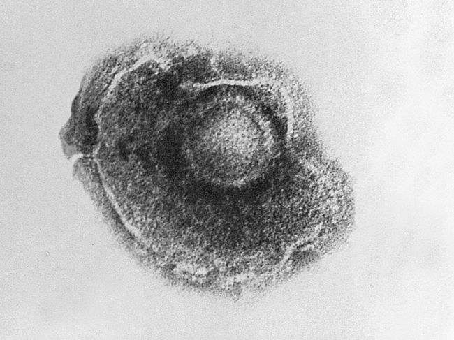 Transmission electron microscopic image of varicella zoster virus.