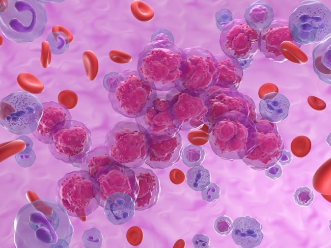 3D illustration of acute lymphoblastic leukemia in blood.