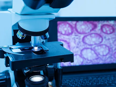 Microscope with laptop displaying histology image.
