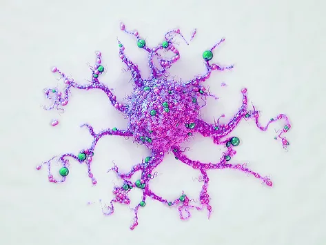 Illustration of metastatic cancer