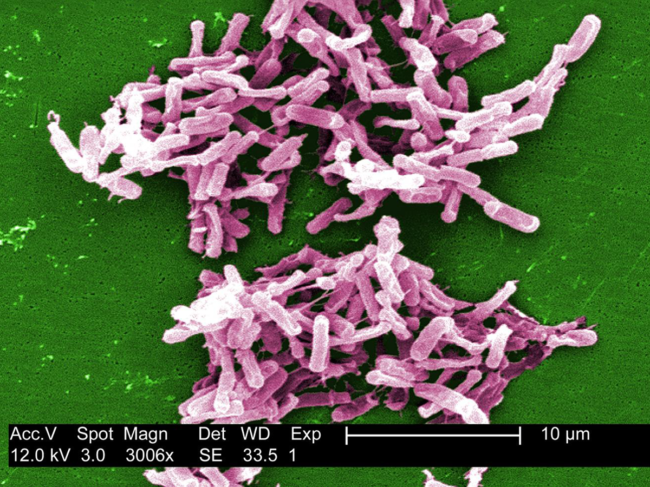 Digitally colorized scanning electron microscopic image of C. difficile bacteria.