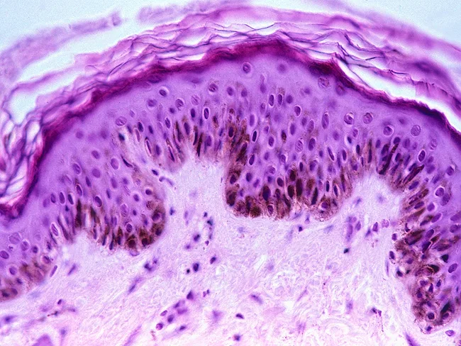 Microscopic cross section of skin