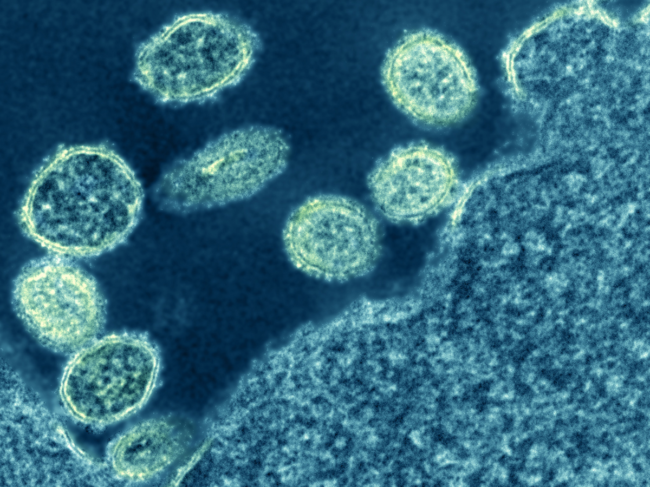 Transmission electron micrograph of H1N1.