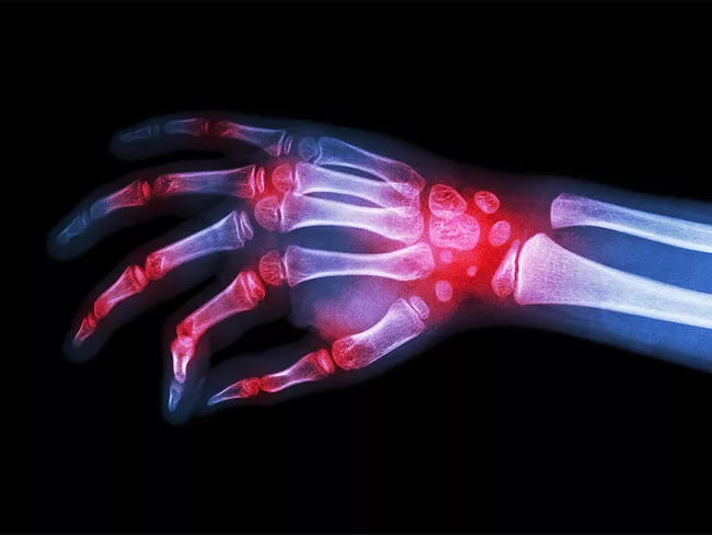 X-ray image of hand and wrist