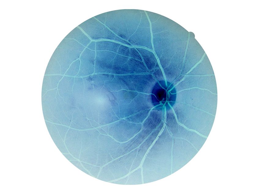 MDT-110 shows efficacy in models of CEP290-related ciliopathies | BioWorld